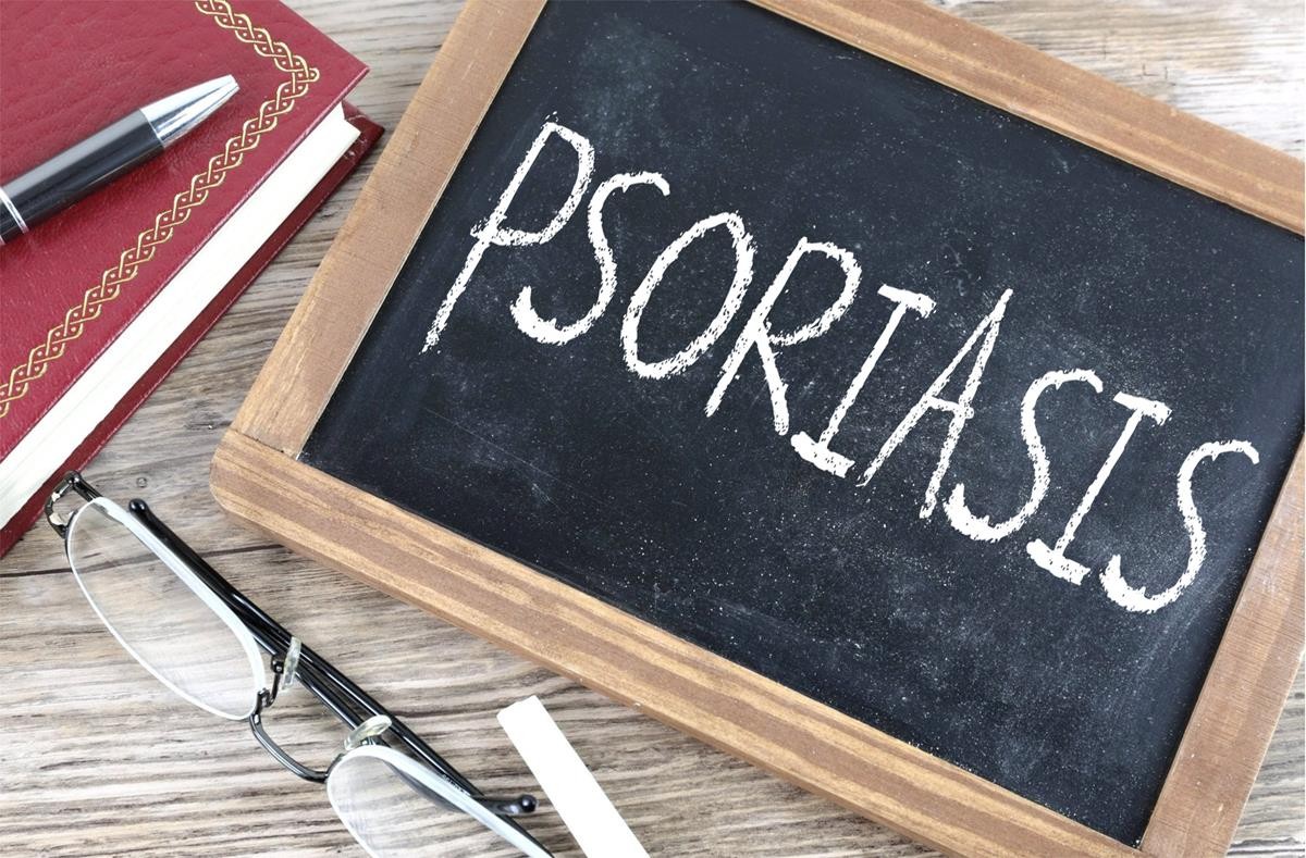 Psoriasi: sintomi, cure, cause